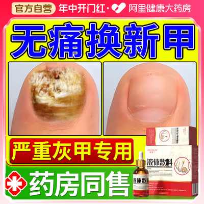 【阿里健康】专攻灰指甲护理盒