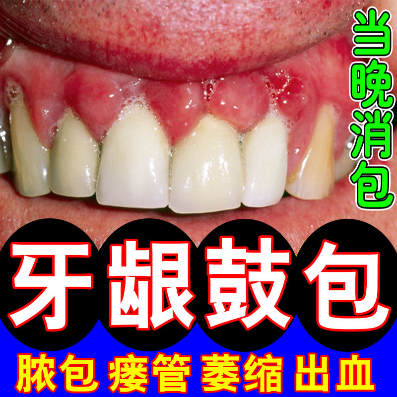 牙龈肿包