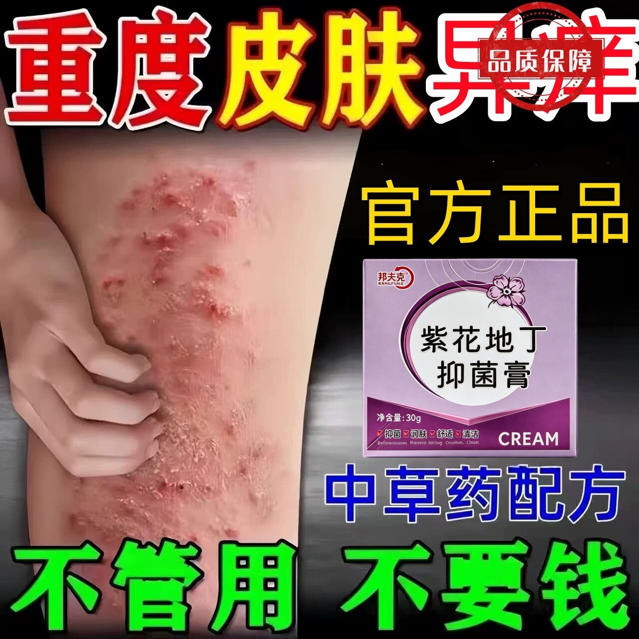 皮肤瘙痒止痒外用身上骚痒过敏紫花地丁蚊虫叮咬止痒草本抑菌膏