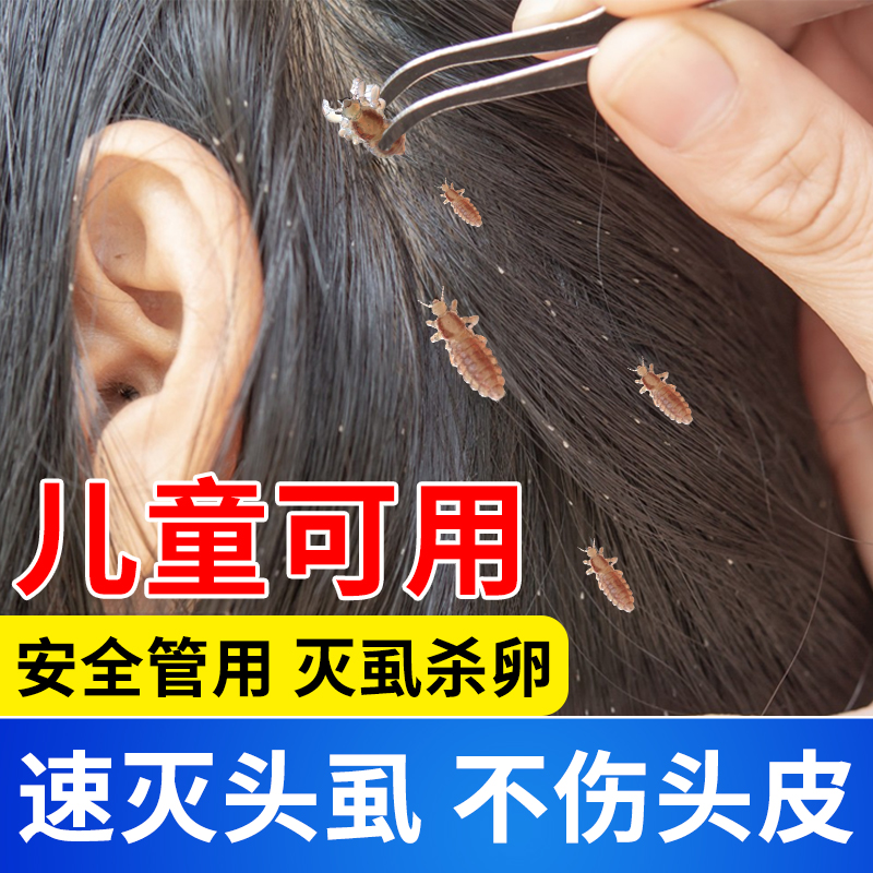 老式除头虱药粉虫卵双杀