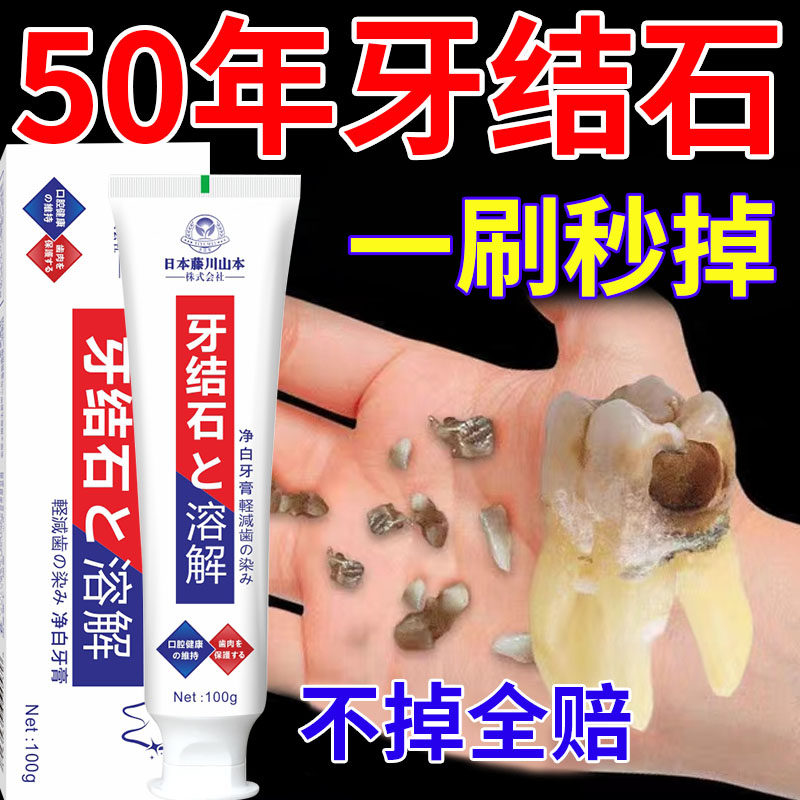溶解牙石速效牙结石去口臭去黄美白去烟渍牙结石去除神器专用牙膏