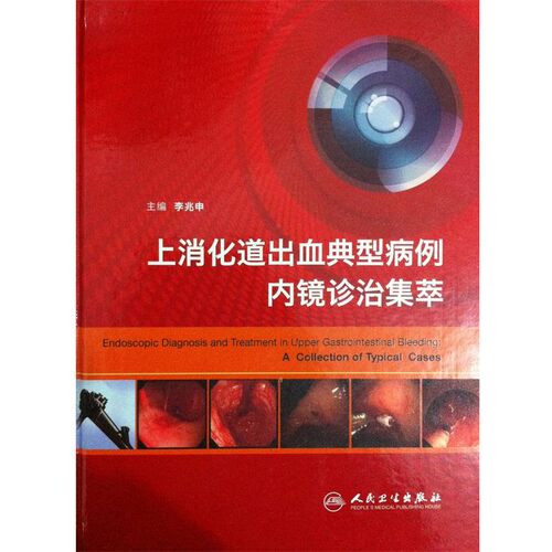 正版包邮上消化道出血典型病例 内镜诊治集萃李兆申 主编人民卫生