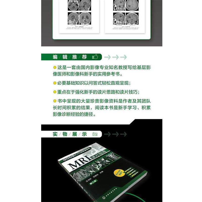 【正版书籍】 影像读片从入门到精通系列--MRI 王书轩 编 化学工业出版社
