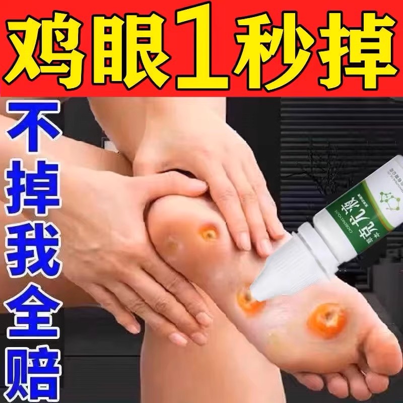 鸡眼膏贴鸡眼药水去肉刺去除足部脚趾老茧疼痛专用正品去鸡眼根
