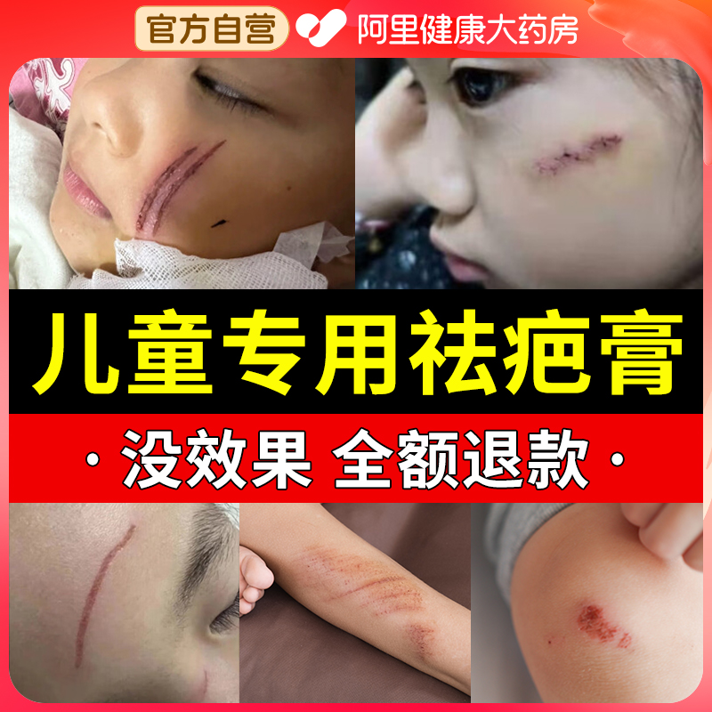 去疤膏儿童专用小孩疤痕修复除疤