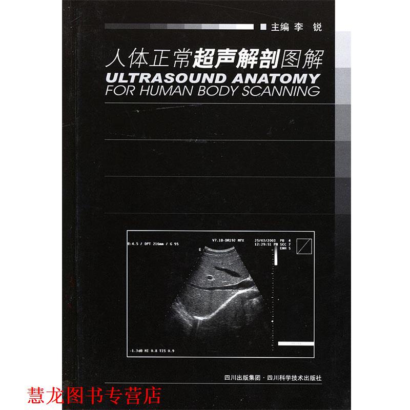 【正版书籍】 人体正常超声解剖图解 李锐 主编 四川科技出版社
