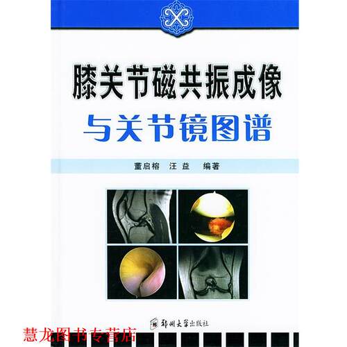【正版书籍】 膝关节磁共振成像与关节镜图谱 董启榕,汪益 编著 郑州大学出版社