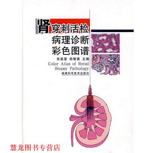 【正版书籍】 肾穿刺活检病理诊断彩色图谱 余英豪,郑智勇　主编 福建科技出版社