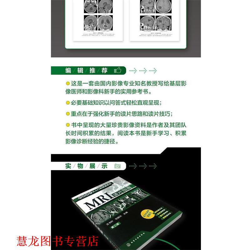 【正版书籍】 影像读片从入门到精通系列--MRI 王书轩 编 化学工业出版社