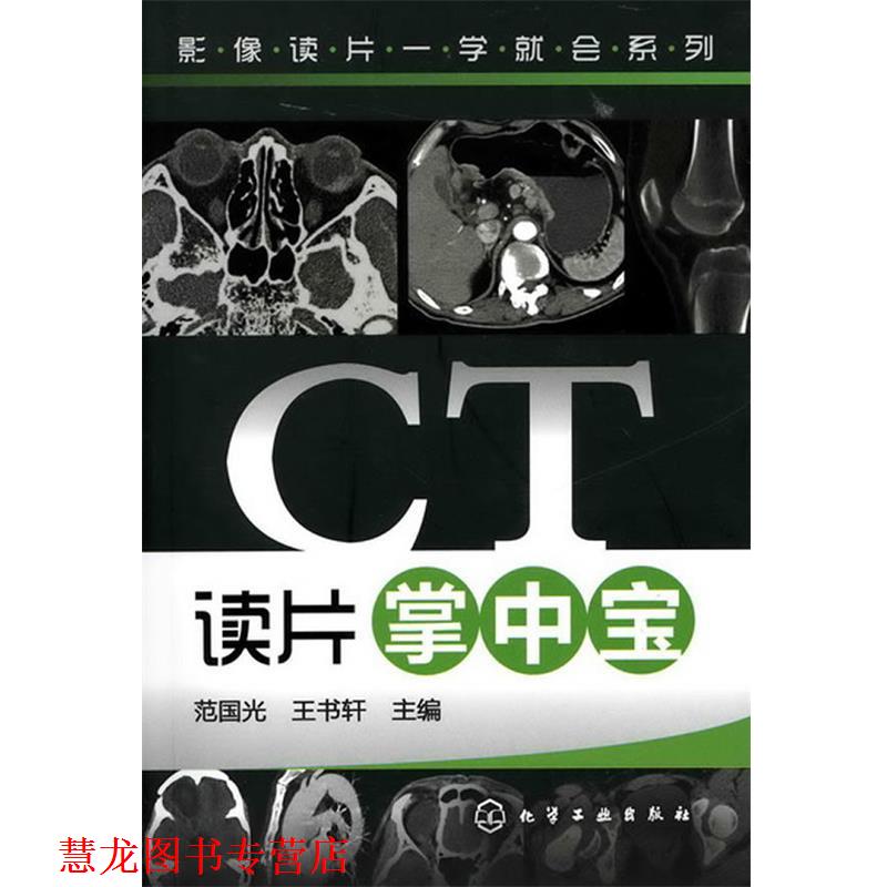 【正版书籍】 影像读片一学就会系列--CT读片掌中宝 范国光 化学工业出版社