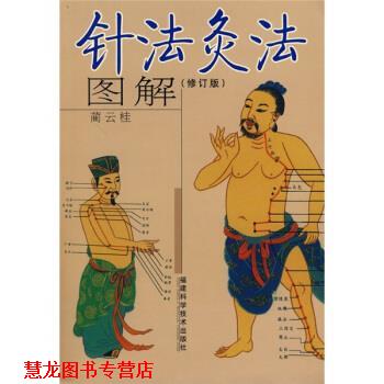 【正版书籍】 针法灸法图解 蔺云桂 著 福建科学技术出版社