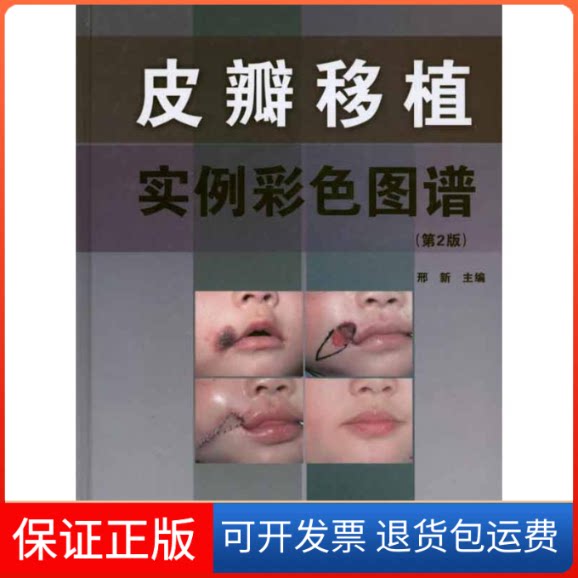【保正版】皮瓣移植实例彩色图谱(第2版)邢新 主编辽宁科学技术出版社9787538168174