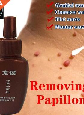 20M Skin Tag Remover Genital Wart Treatment Instant Removal