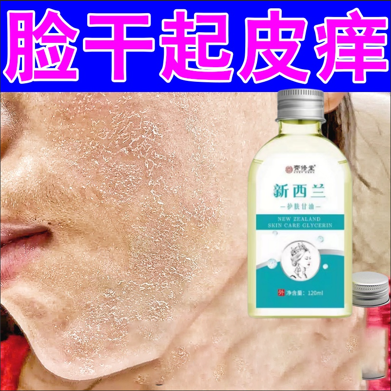 换季脸干燥起皮掉皮屑修复霜脸上起皮脱皮泛红干痒嘴角周围起干皮
