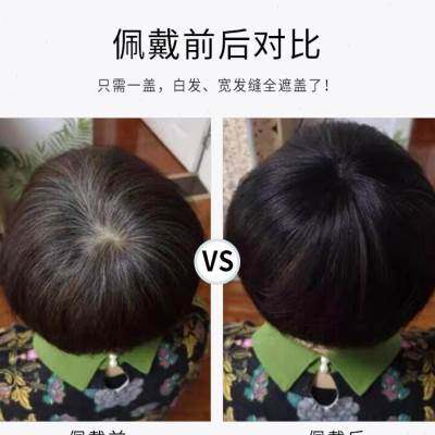 头顶真发补发片老人盖白发递针全真人发短发假发片女遮秃顶盖全头