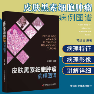 中国科学技术出版 常建民编著 社书籍 本书尤其适合皮肤科临床医师以及病理科医师参考使用 D皮肤黑素细胞肿瘤病理图谱