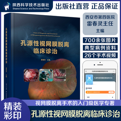 孔源性视网膜脱离临床诊治