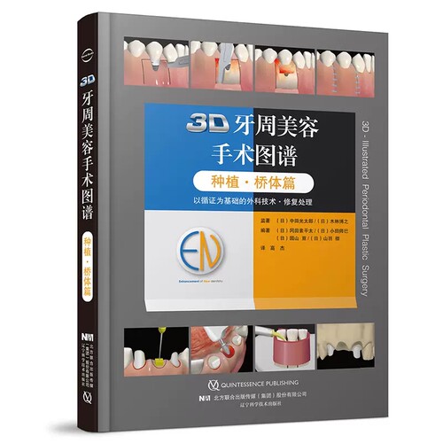 3D牙周美容手术图谱 种植·桥体篇 口腔科书籍 医学参考书籍 2020年1月DIYI版 冈田素平太等编著9787559117243辽宁科学技术出版