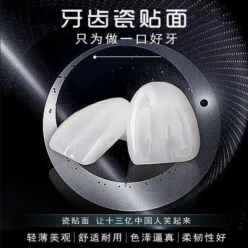 牙齿贴面全瓷牙贴片义获嘉全瓷贴面牙齿贴面全瓷牙贴面美白牙贴片