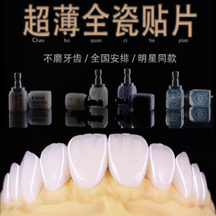 全瓷贴面超薄义获嘉灵犀瓷蓝瓷牙缝黄牙遮色美白瓷贴面牙齿贴片