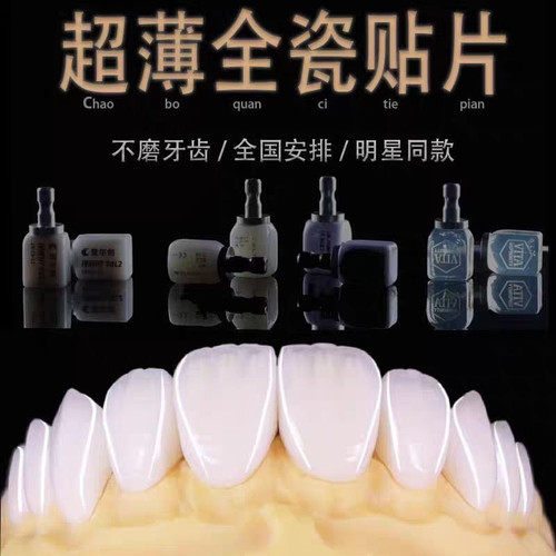 全瓷贴面超薄义获嘉灵犀瓷蓝瓷牙缝黄牙遮色美白瓷贴面牙齿贴片