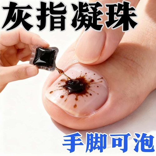 【香港专研】免熬煮灰指凝珠专用泡甲杀真 [菌]手脚指泡脚袋足液