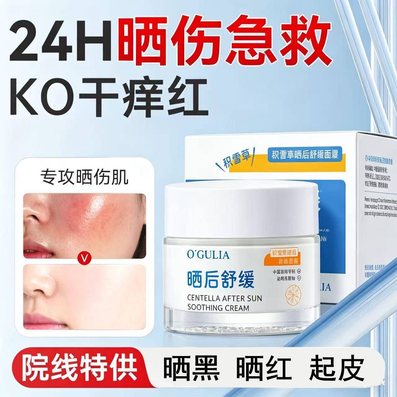 正品太阳晒伤后夏季晒后皮肤面霜舒缓清爽脸部脖子手臂女男士专用