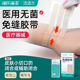 海氏海诺减张贴减张器疤痕医用伤口儿童婴儿皮肤切痣闭合免缝胶带