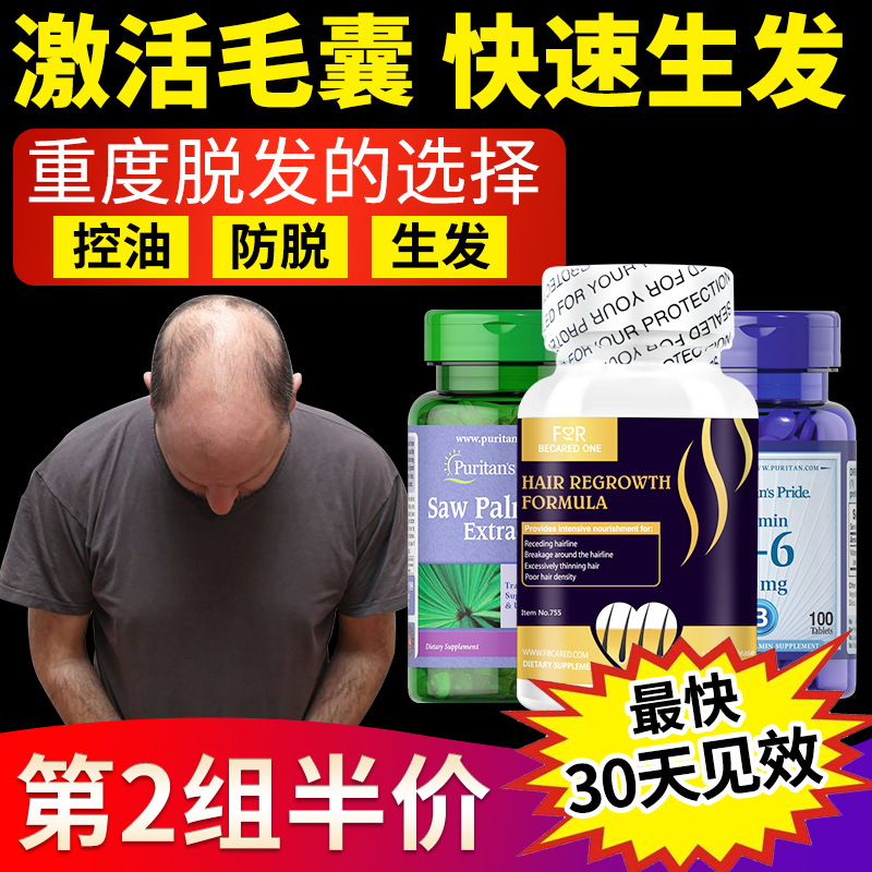 养血生发发胶囊维生素b7 b6 维生素h胱氨酸片女性男性防脱发掉发