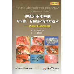 包邮 社 译种植牙手术中 从基础开始快速进阶 正版 骨移植和骨成形技术 段建民 骨采集 人民军医出版 嶋田淳 旧书 著