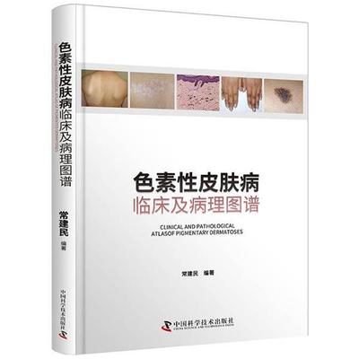 常建民色素性皮肤病：临床及病理图谱（正版旧书包邮）中国科学技术出版社9787504685940