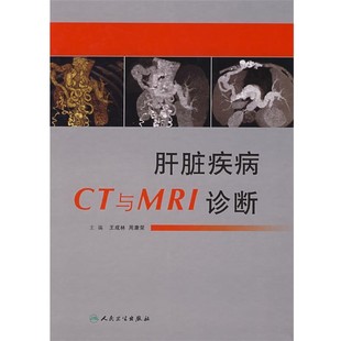 等主编肝脏疾病CT与MRI诊断 人民卫生出版 正版 包邮 社9787117088299 旧书 王成林