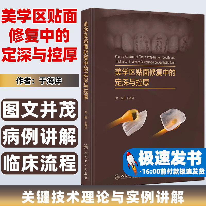 美学区贴面修复中的定深与控厚