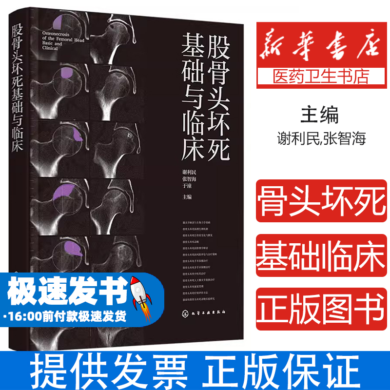 股骨头坏死基础与临床谢利民,张智海,于潼 主编 编化学工业出版社9787122475930医学卫生/外科学