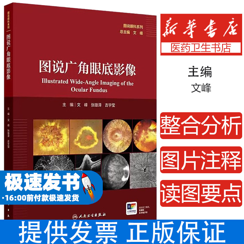 图说广角眼底影像 主编文峰 张雄泽 吉宇莹 遗传性视网膜脉络膜病变 眼底炎症与感染 视网膜血管性疾病9787117370912人民卫生出版