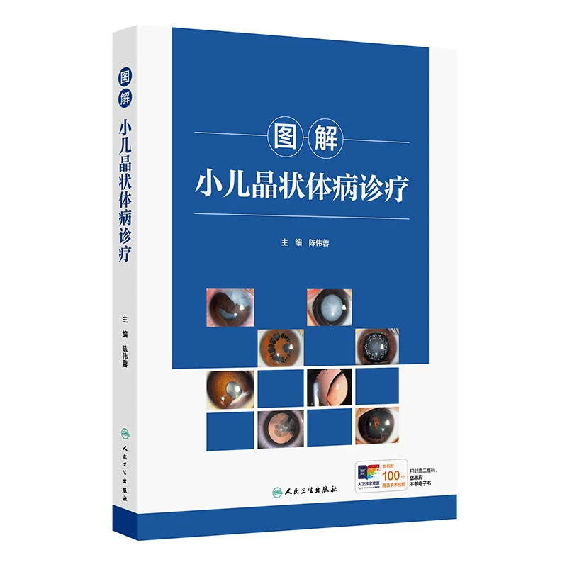 图解小儿晶状体病诊疗配增值陈伟蓉人民卫生出版社9787117396554