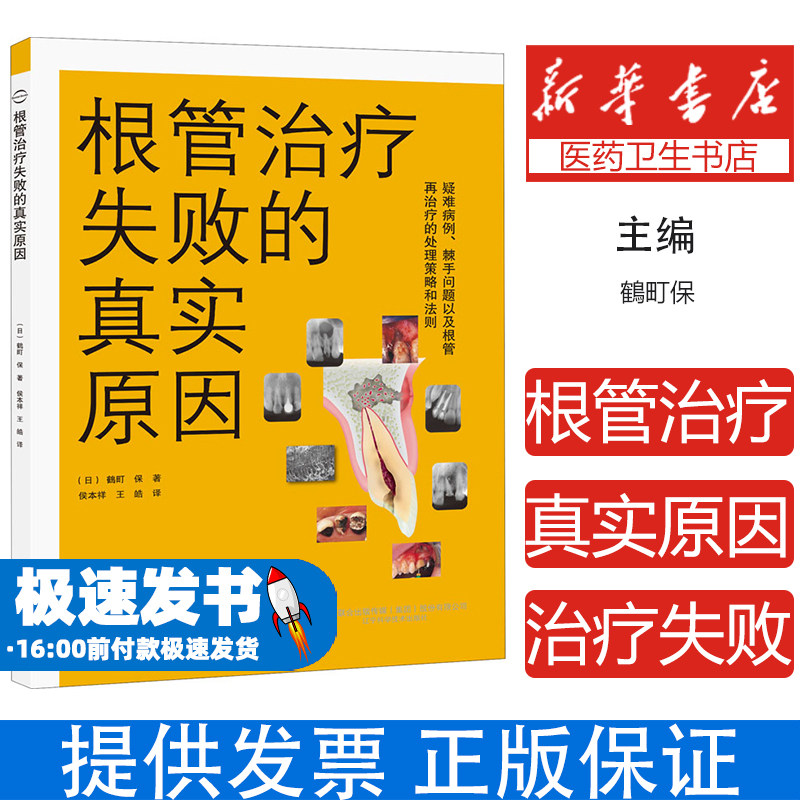 根管治疗失败的真实原因 鶴町保 临床医学口腔科牙体 牙齿种植畸形矫正手术技巧根管工具操作教程 辽宁科技9787559114471