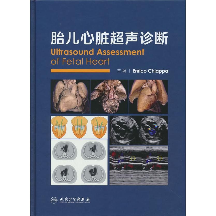 胎儿心脏超声诊断EnricoChiappa人民卫生出版社产前诊断胎儿医学影像诊断超声医学妇产科学先天性心脏病筛查超声心动图检查临床操