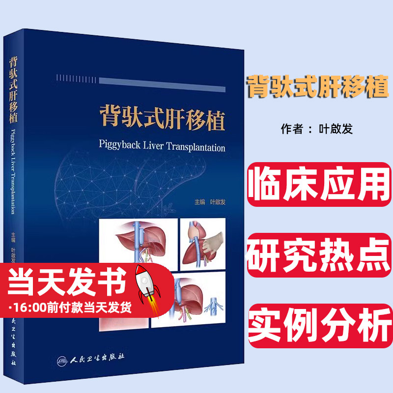 背驮式肝移植叶啟发主编背驮式
