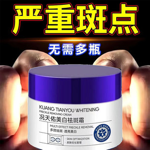 小理博士美白祛斑霜提亮肤色去暗黄褐雀斑淡化色斑晒斑雀斑老年斑