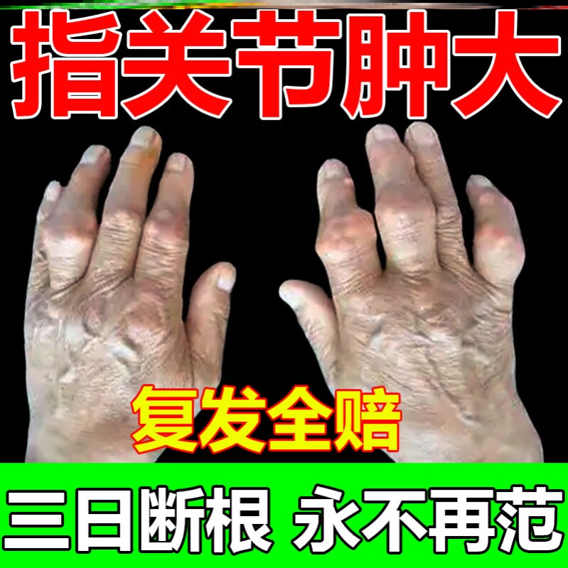 内风湿手指关节变形肿大粗疼痛酸麻僵硬药理疗器腱鞘炎痛风消结晶