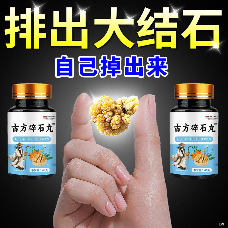 【溶石】鸡内金碎石丸化石溶石洁石去输尿管胆囊膀胱结肾石