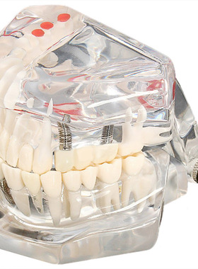Tooth model model dental care model denture dentist Dental D