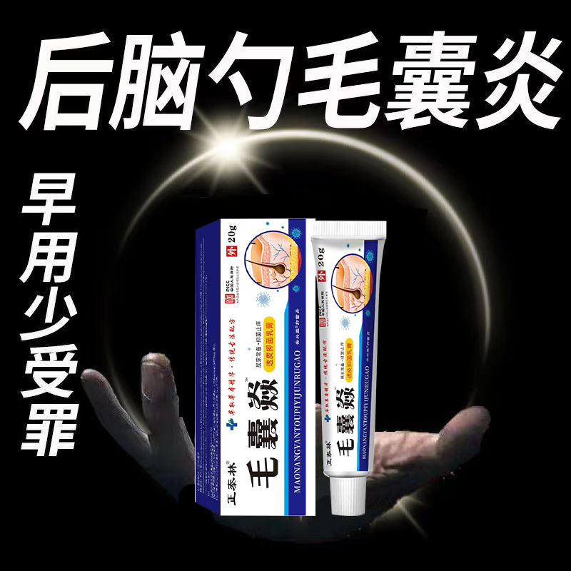 毛囊炎头上长痘痘脓包疙瘩头癣脓疮毛囊发炎堵塞抑菌消炎乳膏
