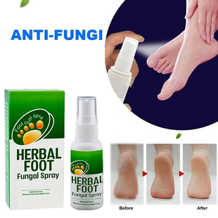 Foot Skin Care Anti-fungal Infections Onychomycosis
