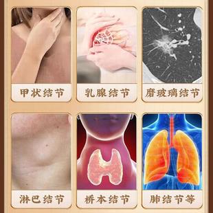 李珍御BTE方时夏化结王公枯草蒲英白芷甲状腺