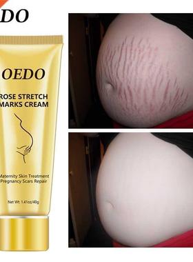 Rose Remove Stretch Marks Cream Anti Wrinkle Anti Aging Mate