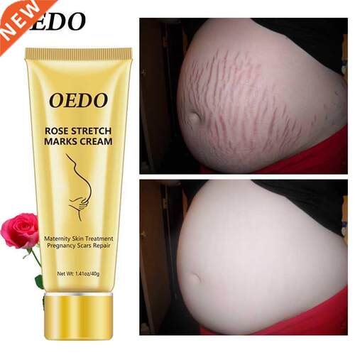 Rose Remove Stretch Marks Cream Anti Wrinkle Anti Aging Mate