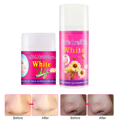 New Nose Mask Blackheads Remover Cream Black Head Face Mask