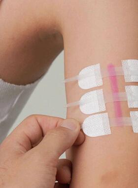 Band-Aid Zipper Tie Wound Closure Patch Hemostatic Patch Wou